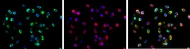 Anti-Dengue virus Envelope protein antibody used in IHC (Paraffin sections) (IHC-P). GTX127277