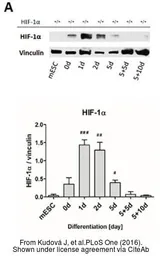 Anti-HIF1 alpha antibody used in Western Blot (WB). GTX127309