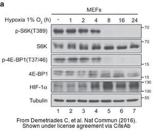 Anti-HIF1 alpha antibody used in Western Blot (WB). GTX127309