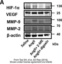 Anti-HIF1 alpha antibody used in Western Blot (WB). GTX127309
