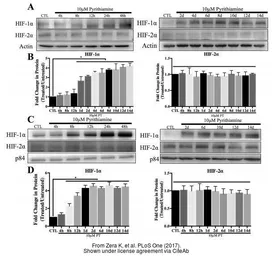 Anti-HIF1 alpha antibody used in Western Blot (WB). GTX127309