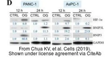 Anti-HIF1 alpha antibody used in Western Blot (WB). GTX127309