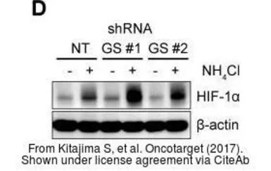 Anti-HIF1 alpha antibody used in Western Blot (WB). GTX127309