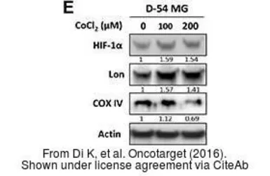 Anti-HIF1 alpha antibody used in Western Blot (WB). GTX127309