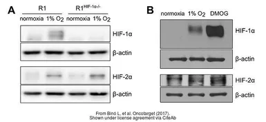 Anti-HIF1 alpha antibody used in Western Blot (WB). GTX127309