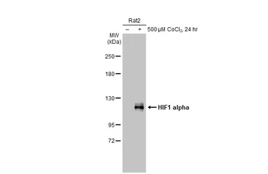 Anti-HIF1 alpha antibody used in Western Blot (WB). GTX127309