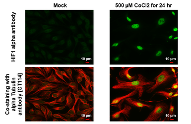 Anti-HIF1 alpha antibody used in Immunocytochemistry/ Immunofluorescence (ICC/IF). GTX127309
