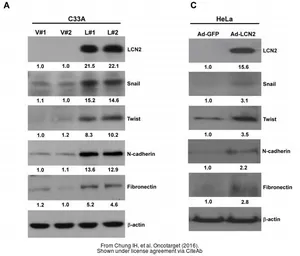 Anti-Twist1/2 antibody used in Western Blot (WB). GTX127310