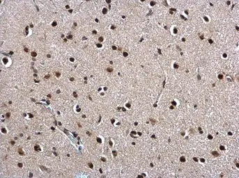 Anti-Twist1/2 antibody used in IHC (Paraffin sections) (IHC-P). GTX127310