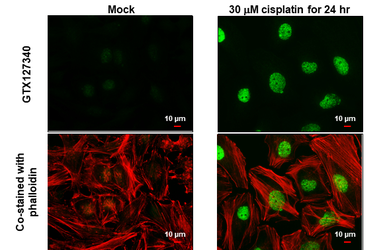 Anti-Histone H2A.XS139ph (phospho Ser139) antibody used in Immunocytochemistry/ Immunofluorescence (ICC/IF). GTX127340