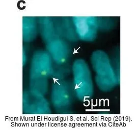 Anti-Histone H2A.XS139ph (phospho Ser139) antibody used in IHC (Whole mount) (IHC-Wm). GTX127342