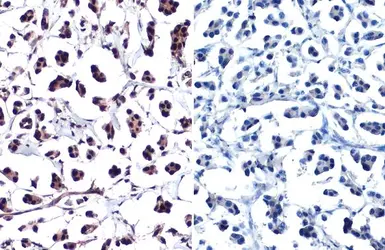 Anti-Histone H2A.XS139ph (phospho Ser139) antibody used in IHC (Paraffin sections) (IHC-P). GTX127342