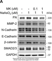 Anti-N-Cadherin antibody used in Western Blot (WB). GTX127345