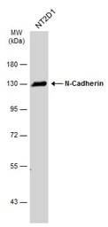 Anti-N-Cadherin antibody used in Western Blot (WB). GTX127345
