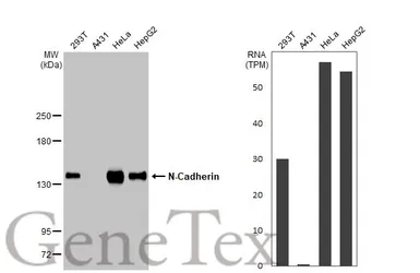 Anti-N-Cadherin antibody used in Western Blot (WB). GTX127345
