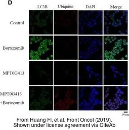 Anti-LC3B antibody used in Immunocytochemistry/ Immunofluorescence (ICC/IF). GTX127375