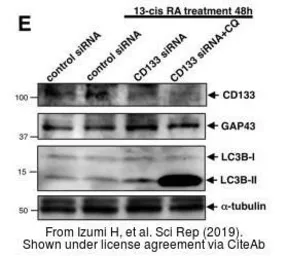 Anti-LC3B antibody used in Western Blot (WB). GTX127375