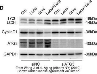 Anti-LC3B antibody used in Western Blot (WB). GTX127375