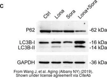 Anti-LC3B antibody used in Western Blot (WB). GTX127375