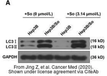 Anti-LC3B antibody used in Western Blot (WB). GTX127375