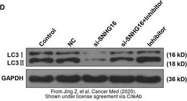 Anti-LC3B antibody used in Western Blot (WB). GTX127375