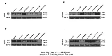 Anti-LC3B antibody used in Western Blot (WB). GTX127375