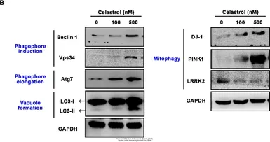 Anti-LC3B antibody used in Western Blot (WB). GTX127375
