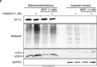Anti-LC3B antibody used in Western Blot (WB). GTX127375