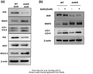 Anti-LC3B antibody used in Western Blot (WB). GTX127375