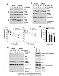 Anti-LC3B antibody used in Western Blot (WB). GTX127375