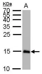 Anti-LC3B antibody used in Western Blot (WB). GTX127375