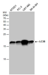 Anti-LC3B antibody used in Western Blot (WB). GTX127375