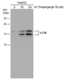 Anti-LC3B antibody used in Western Blot (WB). GTX127375