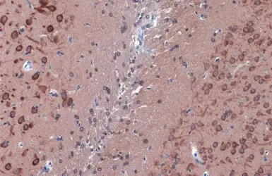 Anti-LC3B antibody used in IHC (Paraffin sections) (IHC-P). GTX127375