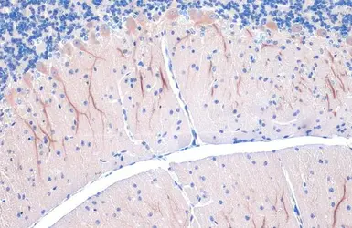 Anti-LC3B antibody used in IHC (Paraffin sections) (IHC-P). GTX127375