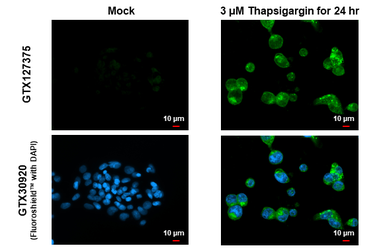 Anti-LC3B antibody used in Immunocytochemistry/ Immunofluorescence (ICC/IF). GTX127375