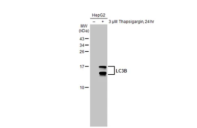 Anti-LC3B antibody used in Western Blot (WB). GTX127375