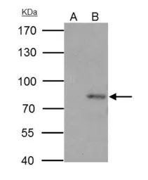 Anti-PAK6 antibody used in Immunoprecipitation (IP). GTX127915