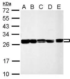 Anti-HMGB1 + HMGB2 antibody used in Western Blot (WB). GTX127972