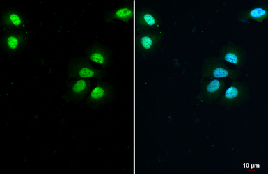Anti-Estrogen Receptor alpha antibody used in Immunocytochemistry/ Immunofluorescence (ICC/IF). GTX127978