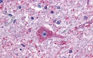 Anti-TM7SF1/GPR137B antibody used in IHC (Paraffin sections) (IHC-P). GTX12800