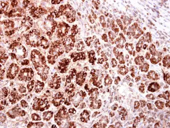 Anti-HMGCS2 antibody used in IHC (Paraffin sections) (IHC-P). GTX128013