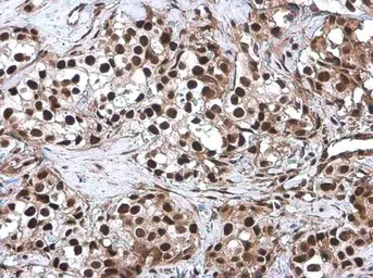 Anti-CFDP1 antibody used in IHC (Paraffin sections) (IHC-P). GTX128024