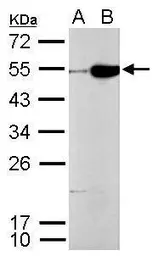 Anti-CFDP1 antibody used in Western Blot (WB). GTX128025