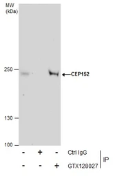Anti-CEP152 antibody used in Immunoprecipitation (IP). GTX128027