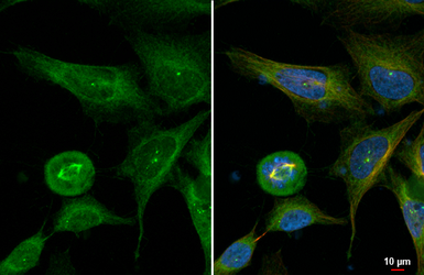 Anti-CEP152 antibody used in Immunocytochemistry/ Immunofluorescence (ICC/IF). GTX128027