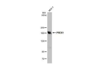 Anti-PREX1 antibody used in Western Blot (WB). GTX128035
