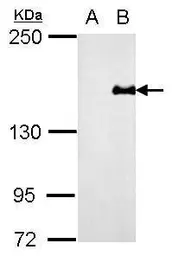 Anti-PREX1 antibody used in Western Blot (WB). GTX128036