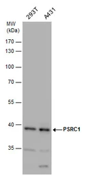 Anti-PSRC1 antibody used in Western Blot (WB). GTX128047