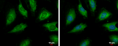 Anti-PSRC1 antibody used in Immunocytochemistry/ Immunofluorescence (ICC/IF). GTX128047